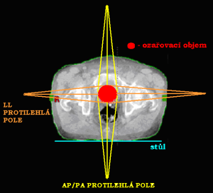 Protilehlá předozadní a zadopřední pole (AP/PA) nebo 2 protilehlá laterolaterální bočná pole (LL)
