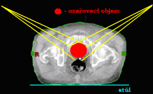 Centrální paprsky ozařovacích svazků svírají určitý úhel