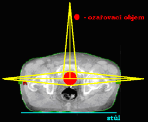 Centrální paprsky tří polí mezi sebou svírají úhel 180°, potažmo 90°